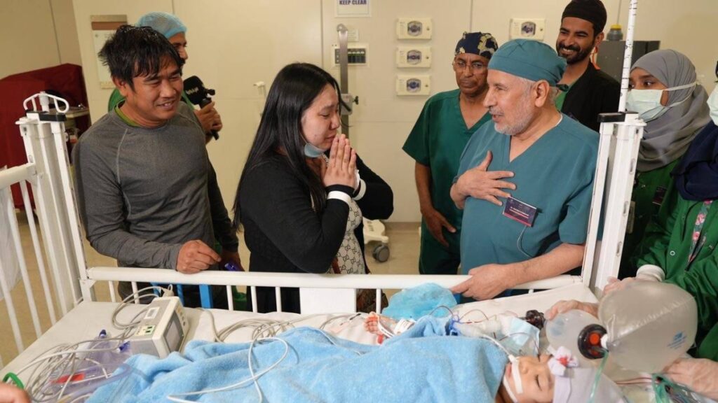في إنجاز طبي جديد.. نجاح عملية فصل التوأم الملتصق الفلبيني (أوليفيا وجيانا) بعد 6 ساعات
