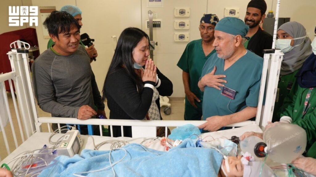 نجاح عملية فصل التوأم
الملتصق الفلبيني (أوليفيا وجيانا) بعد 6 ساعات