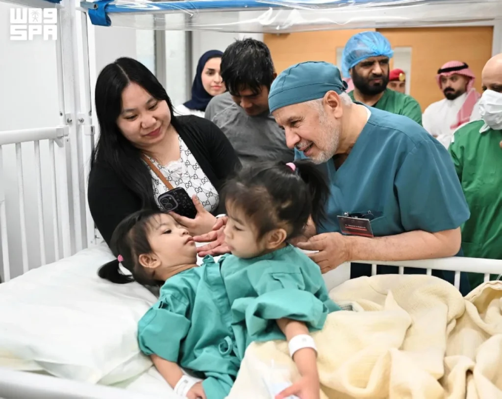Saudi medical team began separation surgery on Filipino conjoined twins