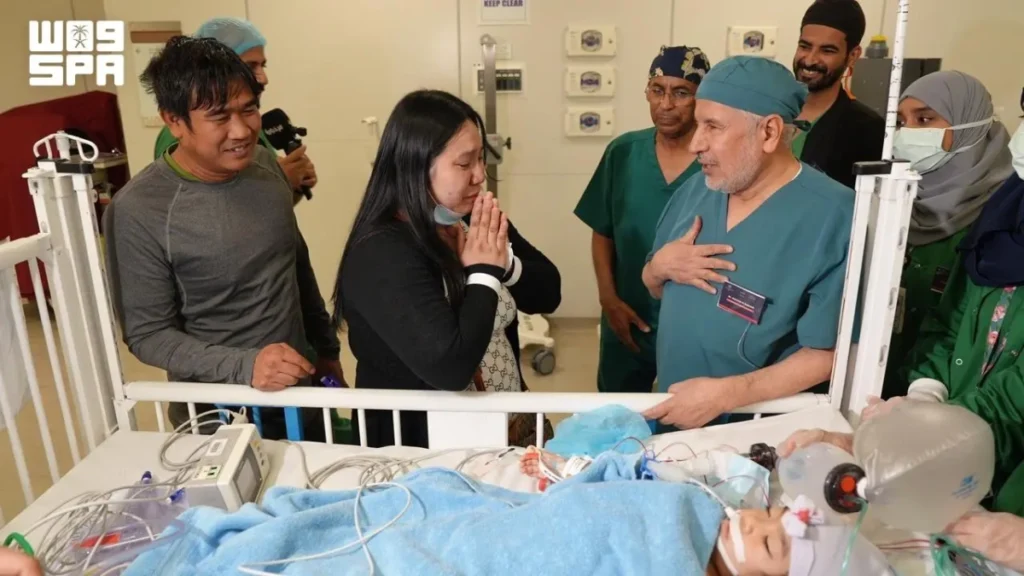 Surgical separation of Filipino conjoined twins successful