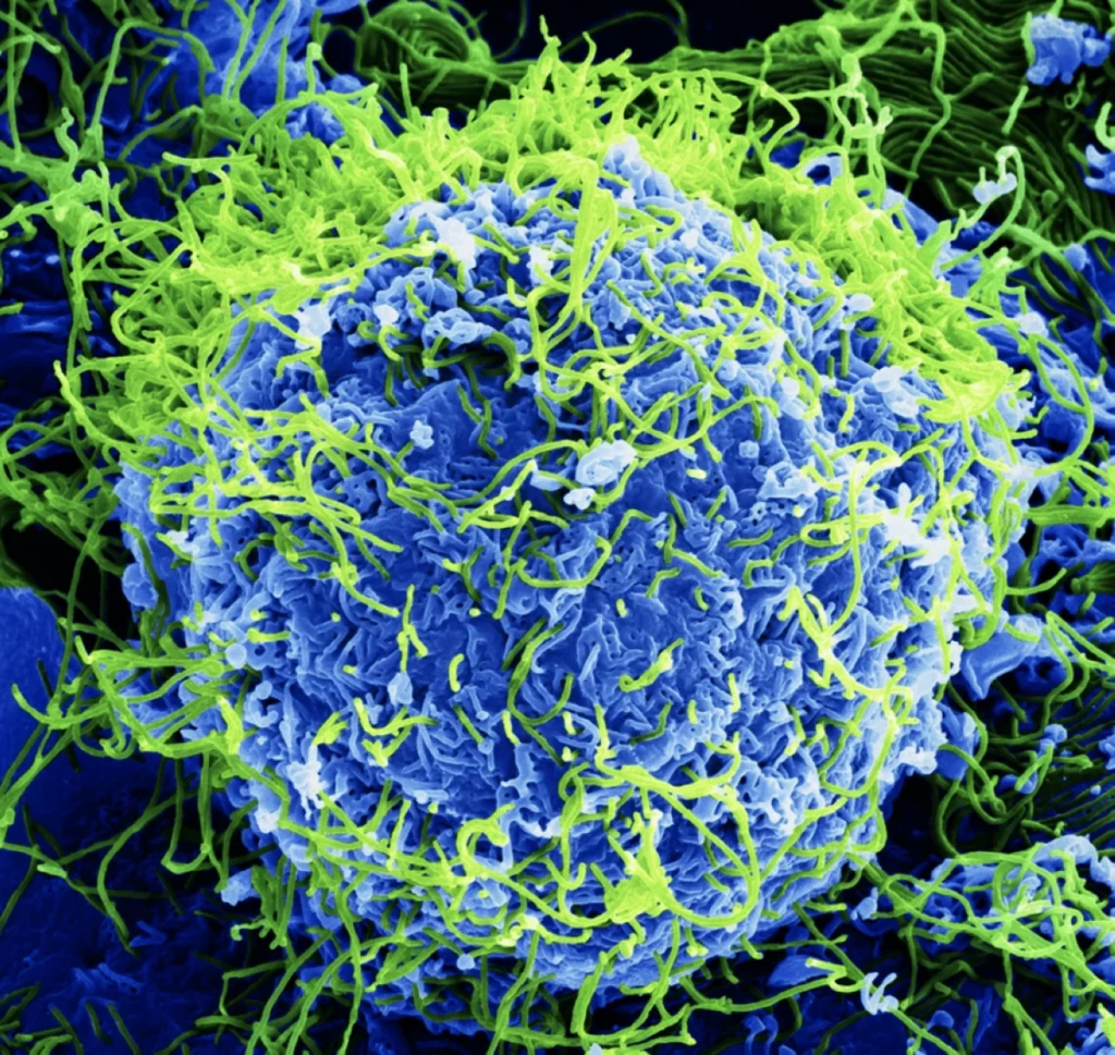 Saudi Arabia bans citizens from traveling to 3 African countries over outbreak of Ebola