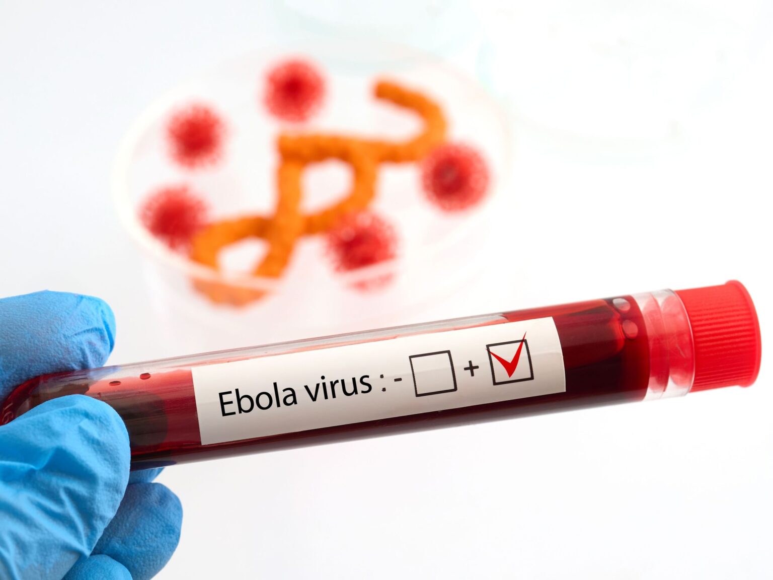 First Ebola patient in France recovers